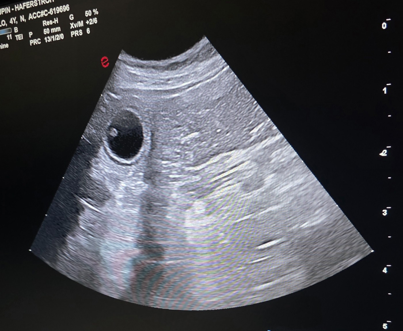 Suzette est confirmée gestante de Viktor!