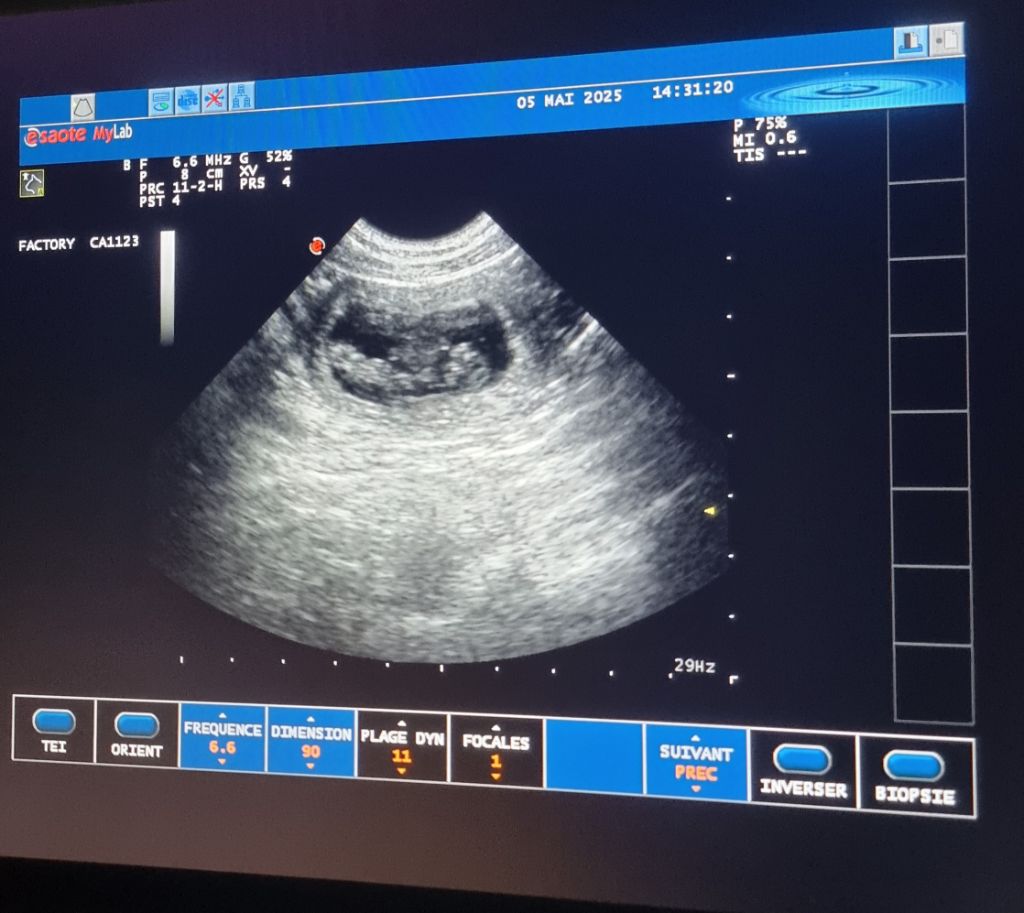 Bientôt des bébés! 